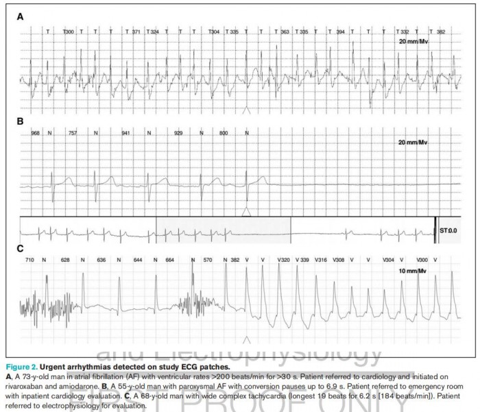 苹果 iOS / iPadOS 18 支持机型及升级方法